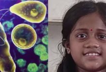 Photo of അമീബിക് മസ്തിഷ്ക ജ്വരം ബാധിച്ച് മരിച്ച ഒൻപത് വയസ്സുകാരി അനയയുടെ സഹോദരനും (7) രോഗബാധ; ചികിത്സ ആരംഭിച്ചു