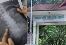 Photo of തിരുവനന്തപുരം ജനറൽ ആശുപത്രിയിലെ ചികിത്സാ പിഴവ്; ഡോ. രാജീവ് കുമാറിനെതിരെ പൊലീസിൽ പരാതി നൽകി