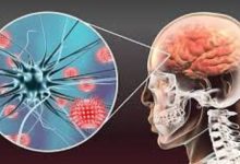 Photo of സംസ്ഥാനത്ത് വീണ്ടും അമീബിക് മസ്തിഷ്‌ക ജ്വരം ബാധിച്ച് മരണം; കൊല്ലം സ്വദേശിനിയായ 65കാരി മരിച്ചു