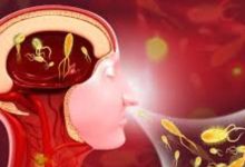 Photo of കൊച്ചിയിലും അമീബിക് മസ്തിഷ്കജ്വരം; ലക്ഷദ്വീപ് സ്വദേശിക്കാണ് രോഗബാധ സ്ഥിരീകരിച്ചു